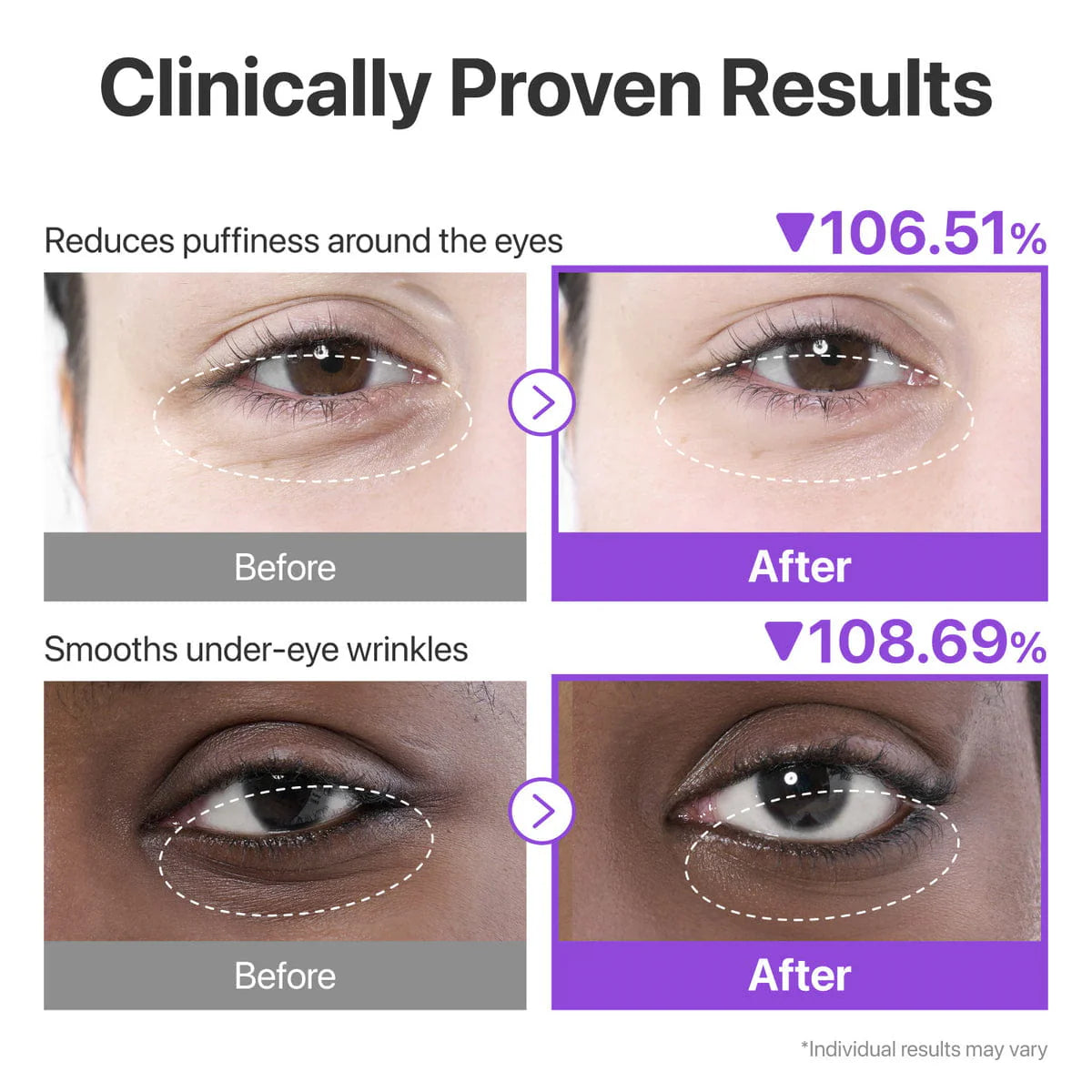 numbuzin No.9 NAD+ Collagen Under Eye Patches