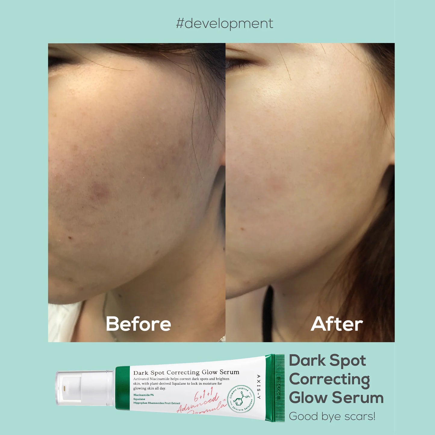 AXIS-Y Dark Spot Correcting Glow Cream
