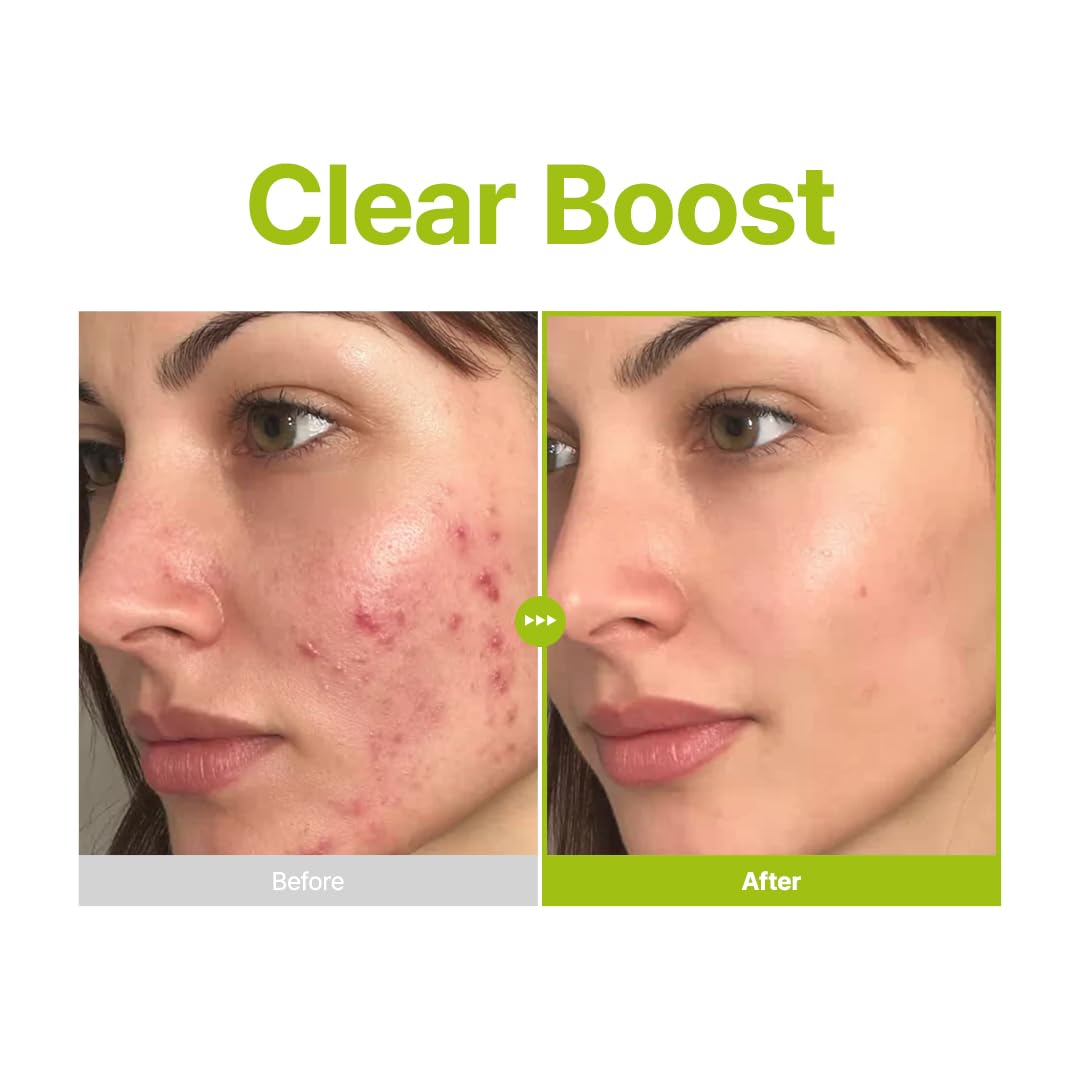 PURITO Azelaic Acid 10% Serum 30ml | cyprus nicosia