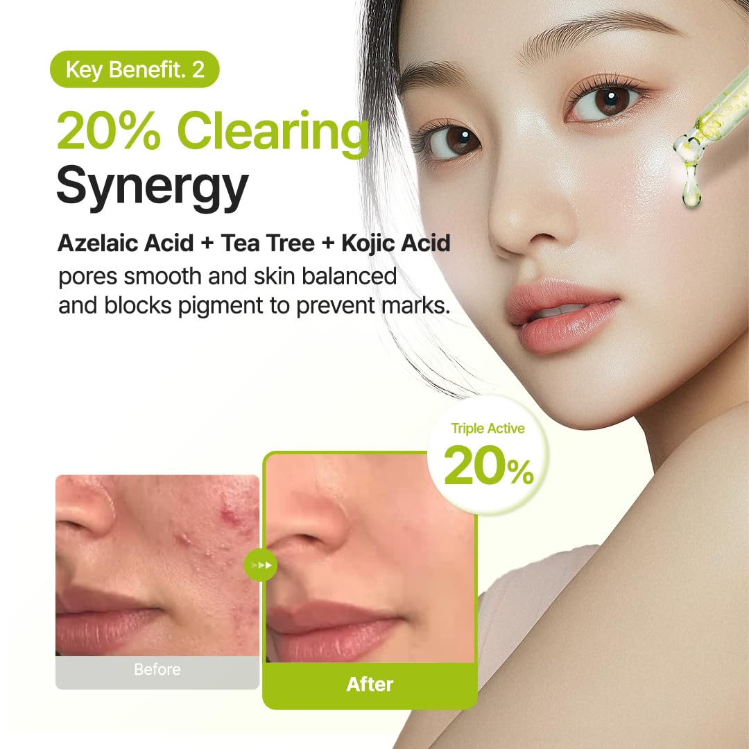 PURITO Azelaic Acid 10% + Kojic Acid + Tea Tree Facial Serum 30ml