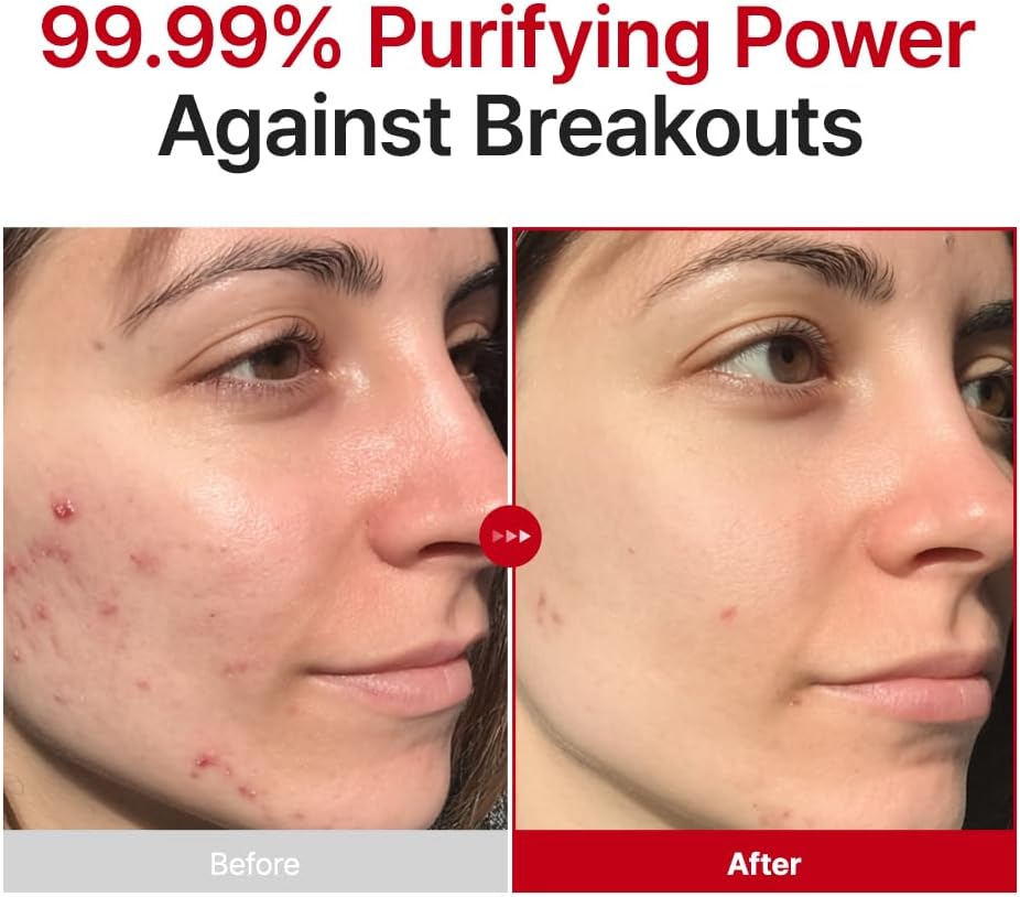 Purito Hypochlorous Acid Rescue Spray soothing antibacterial mist for acne-prone sensitive skin