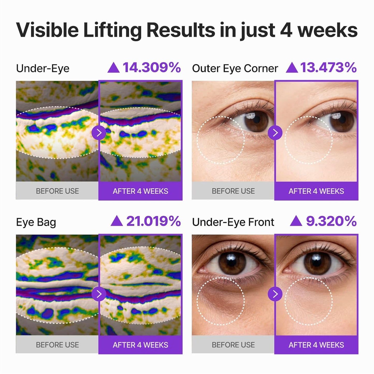 Centellian24 PDRN Lifting Eye Cream 30ml