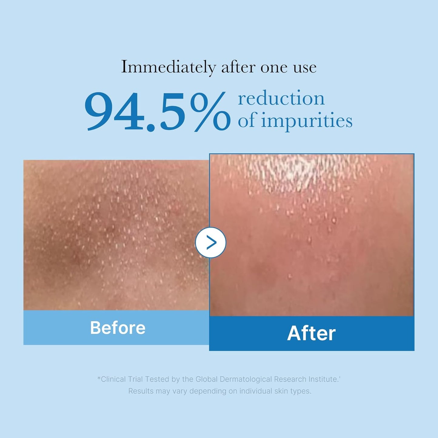 Medicube - Zero Pore Blackhead Deep Cleansing Oil 250ml