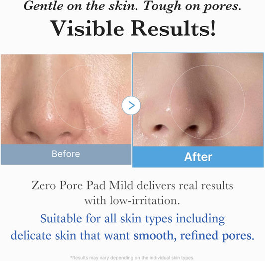Medicube Zero Pore Pads Mild 2.0 – gentle exfoliating and pore-tightening toner pads for sensitive skin, available at Beauty Cave Cyprus.