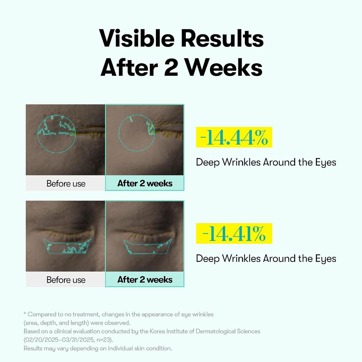 VT Cosmetics PDRN Reedle Shot Eye Cream