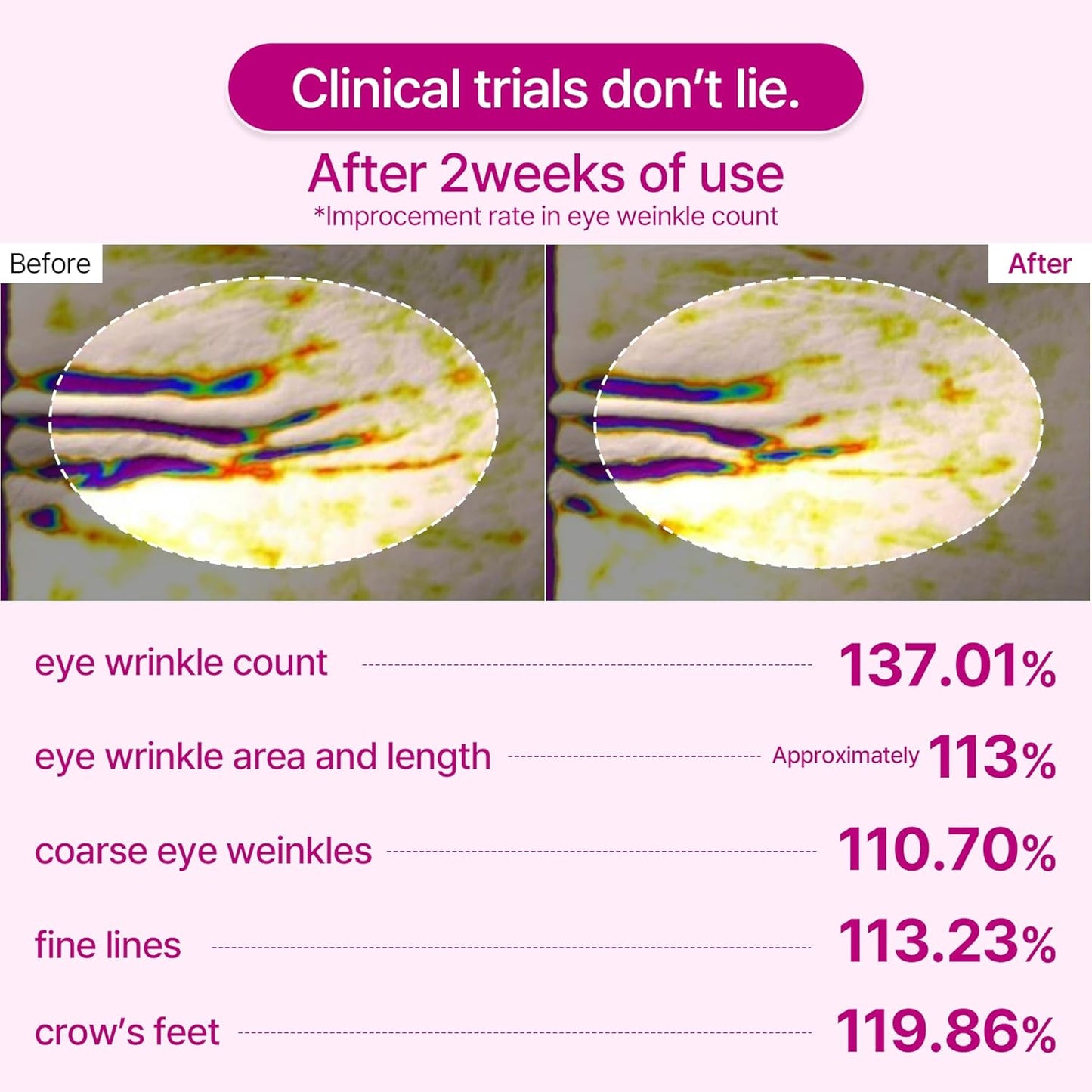 Dr. Melaxin Cemenrete Calcium Volume Eye Patch 60pcs