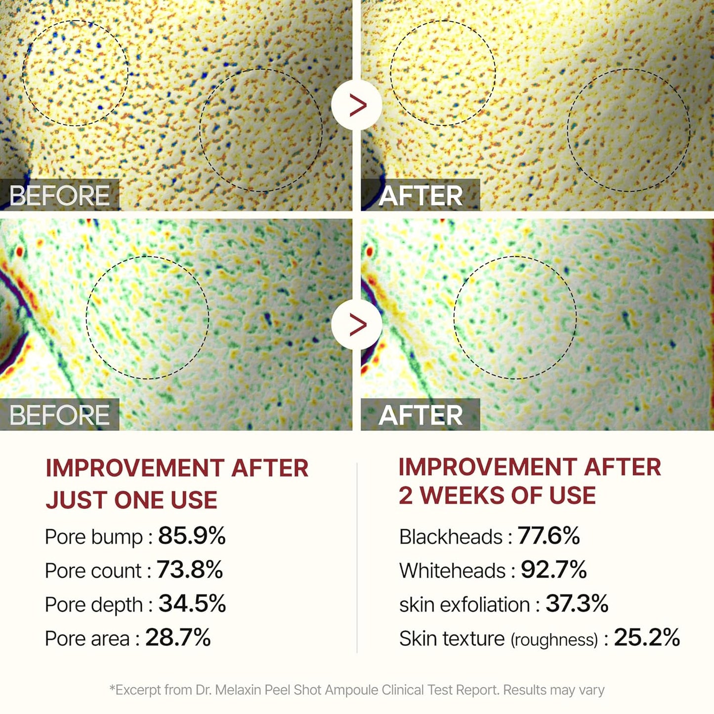 Dr.Melaxin Peel Shot Glow Rice Peeling Ampoule 80ml