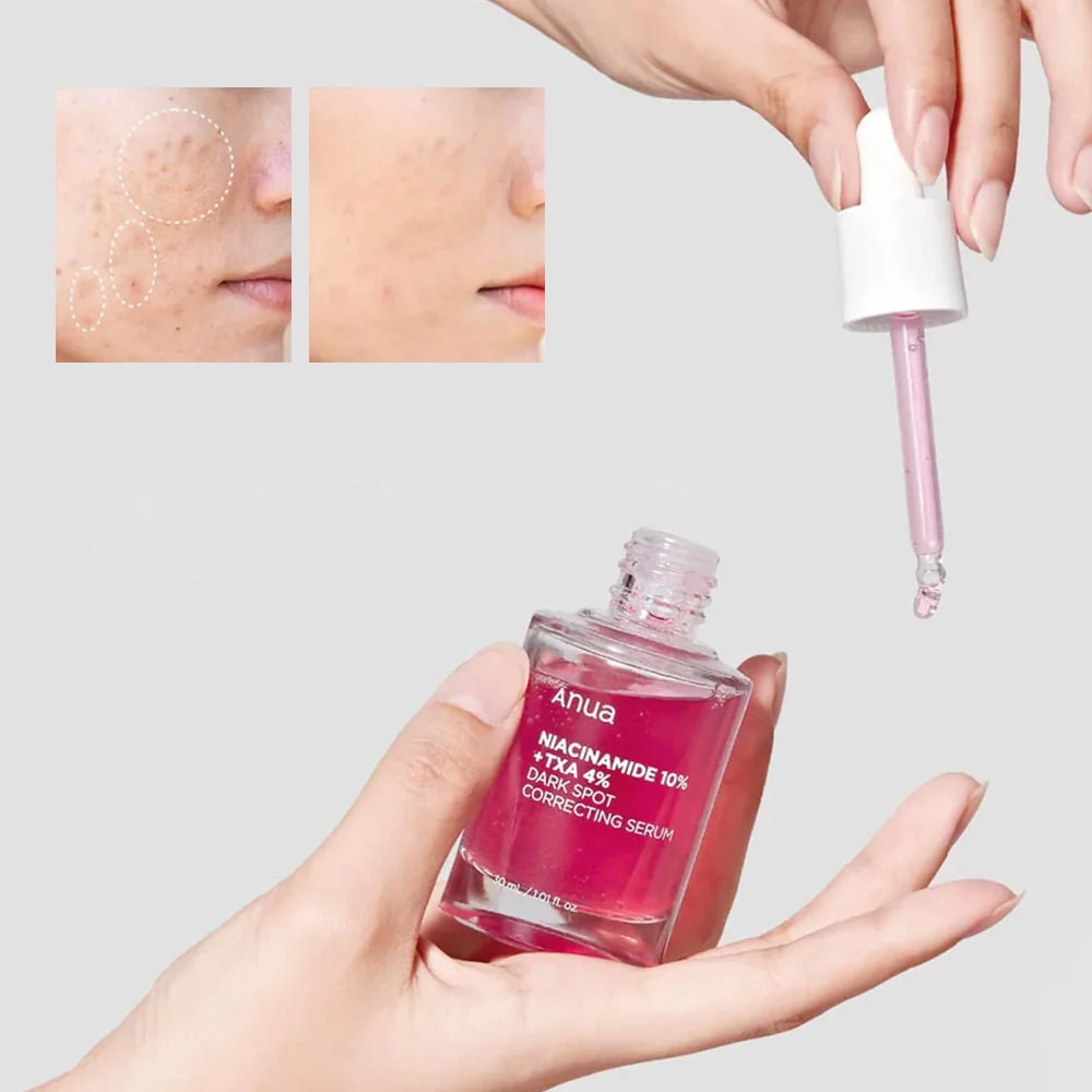 Anua Niacinimide 10%+TXA 4% Dark Spot Correcting Serum 30ML