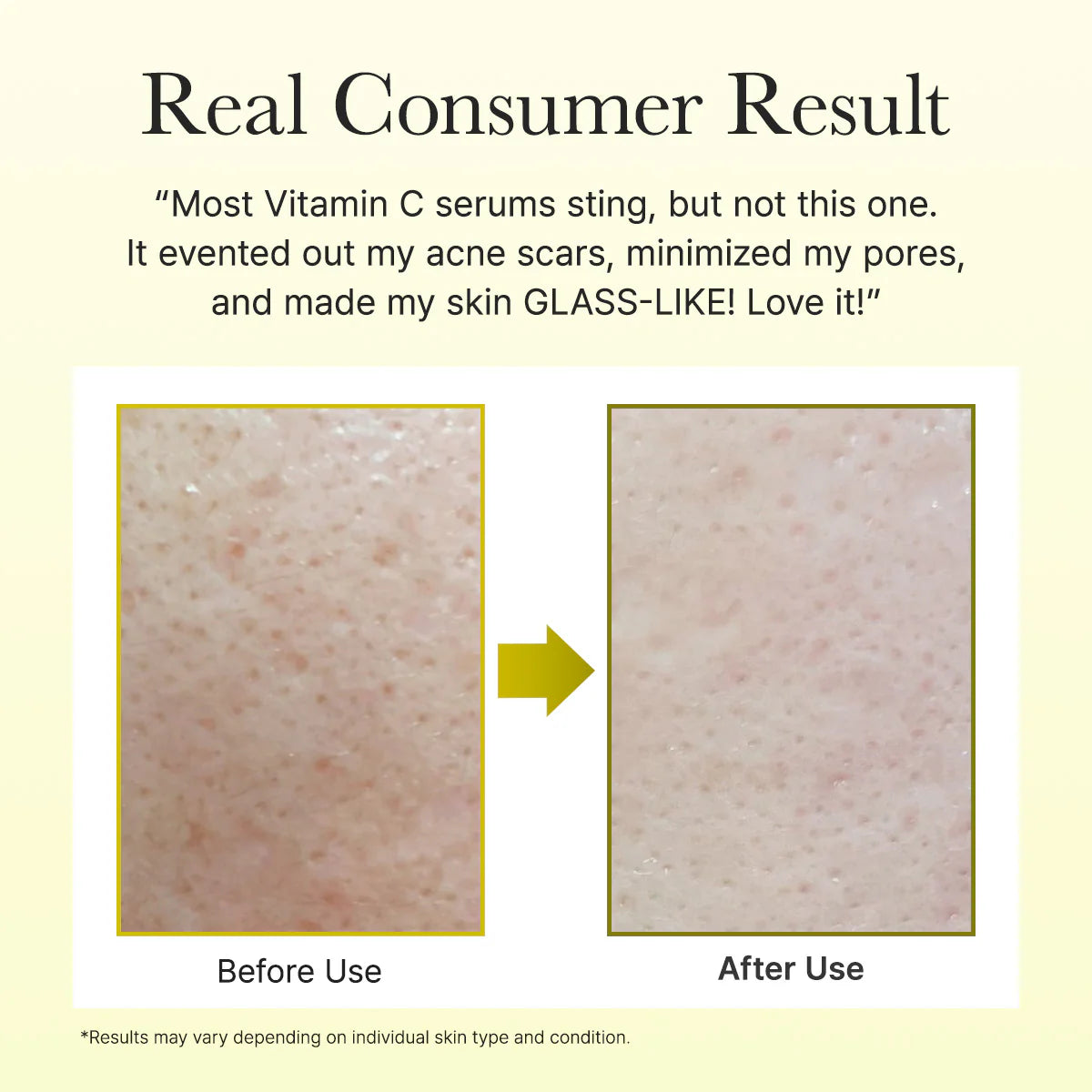 Vitamin C + Glutathione serum texture – glow skincare Cyprus
