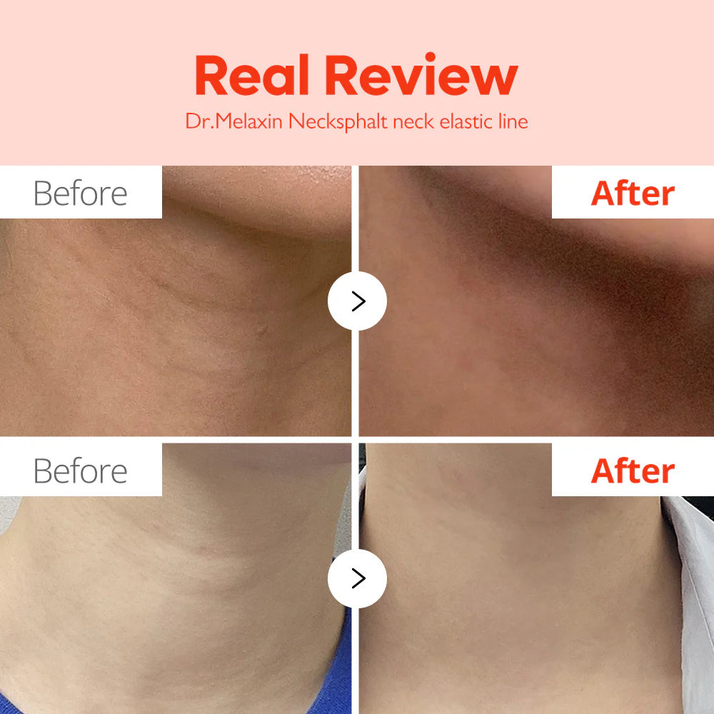 Dr. Melaxin  - Necksphalt ECM Neck Barrier Ampoule