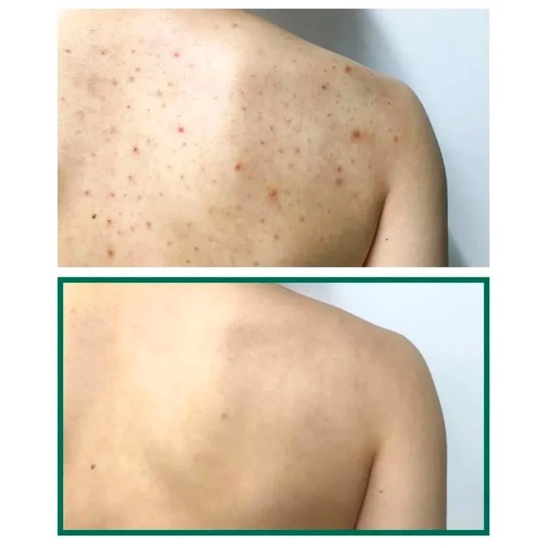 SOME BY MI AHA BHA PHA 30 Days Miracle Acne Clear Body Cleanser