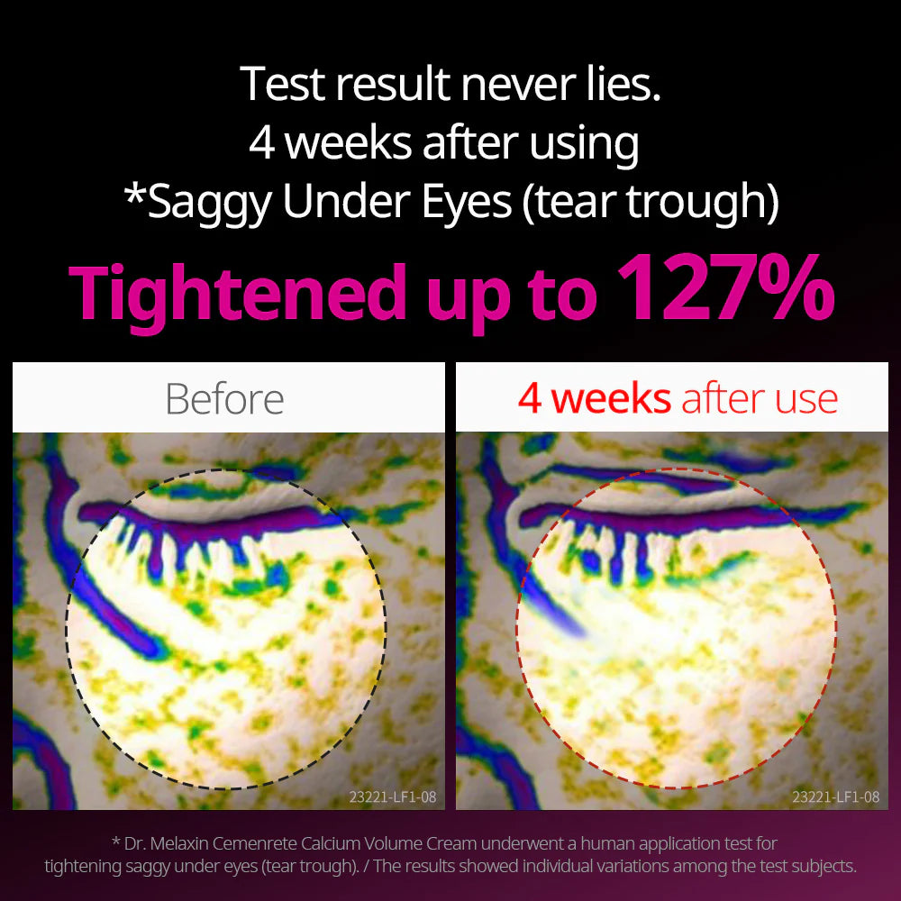 Dr Melaxin Cemenrete Calcium Intense Cream