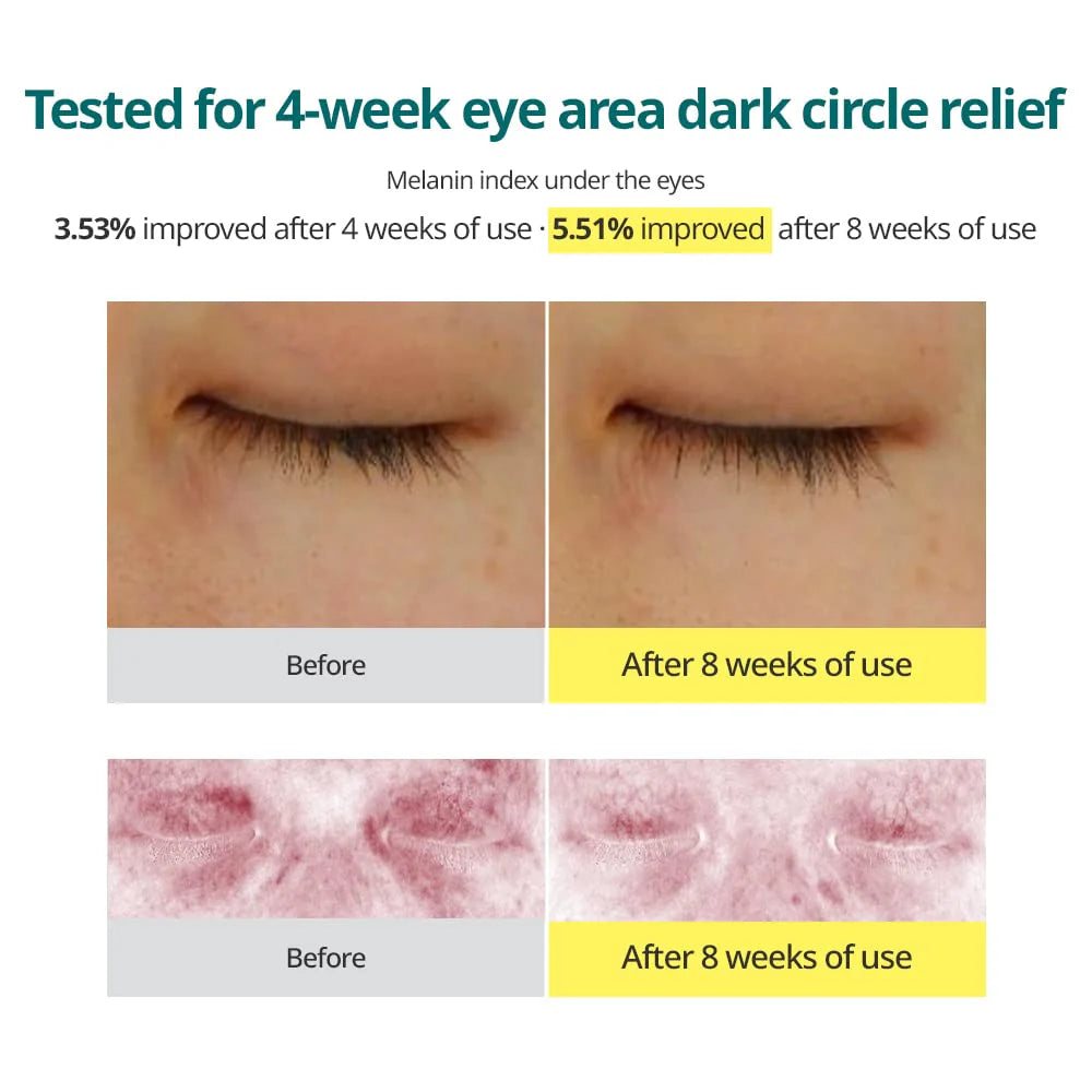 GOODAL Green Tangerine Vita C Eye Care Duo