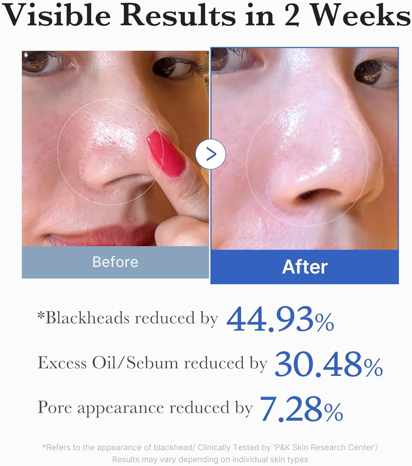 Medicube - Zero Pore Pad 2.0