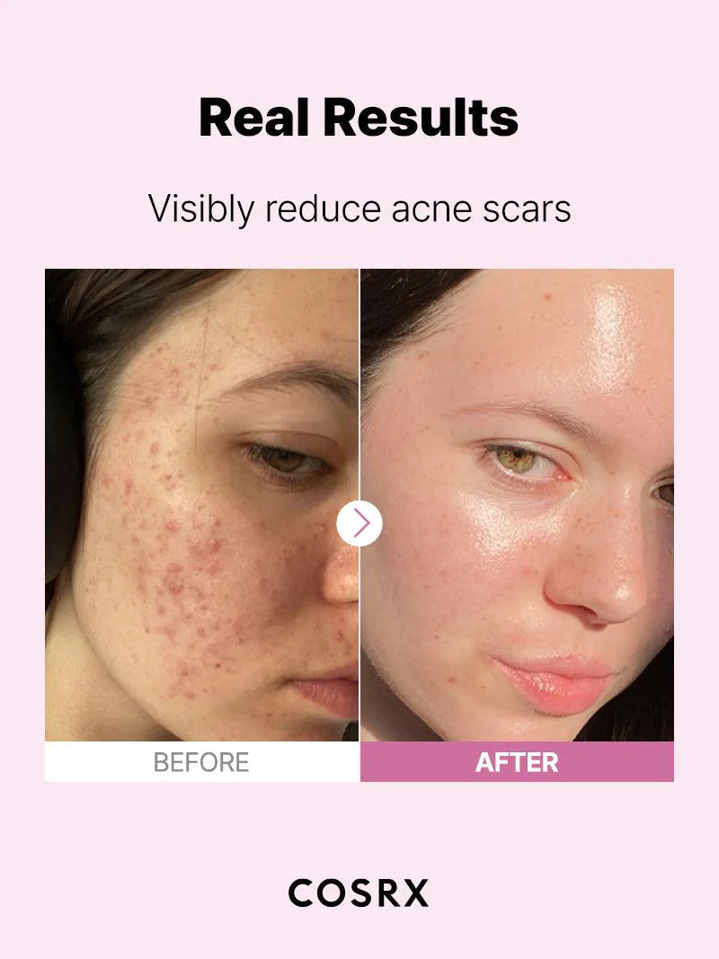 Cosrx The Niacinamide 15 Serum 20ml